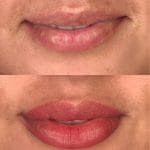 Lip Blushing/Lip Neutralization
